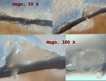 morgellons organisms