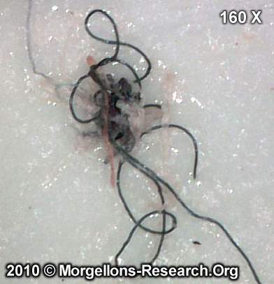 Morgellons Wildlife Form