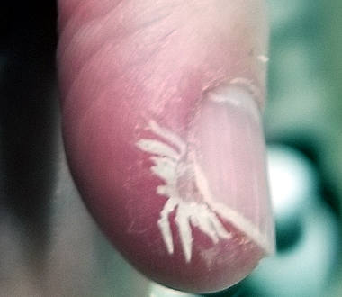 biofilm-finger