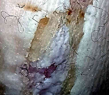 biofilm-foot-fibers