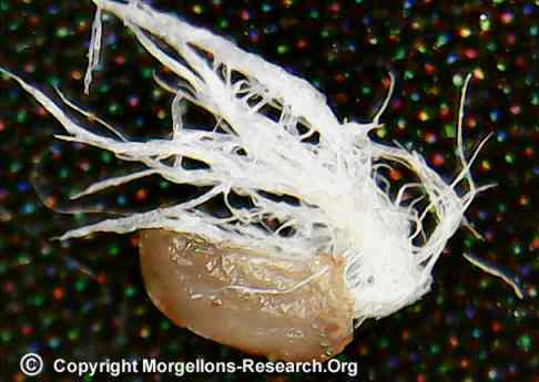 Morgellons Agrobakterium Fäden